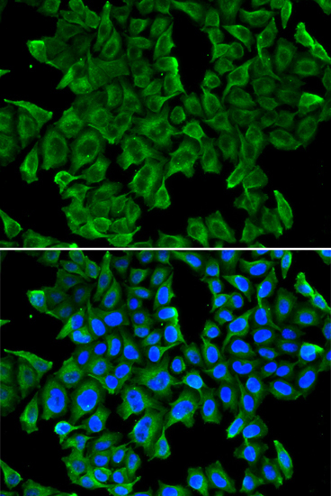 REG3G Rabbit Polyclonal Antibody - Image 2
