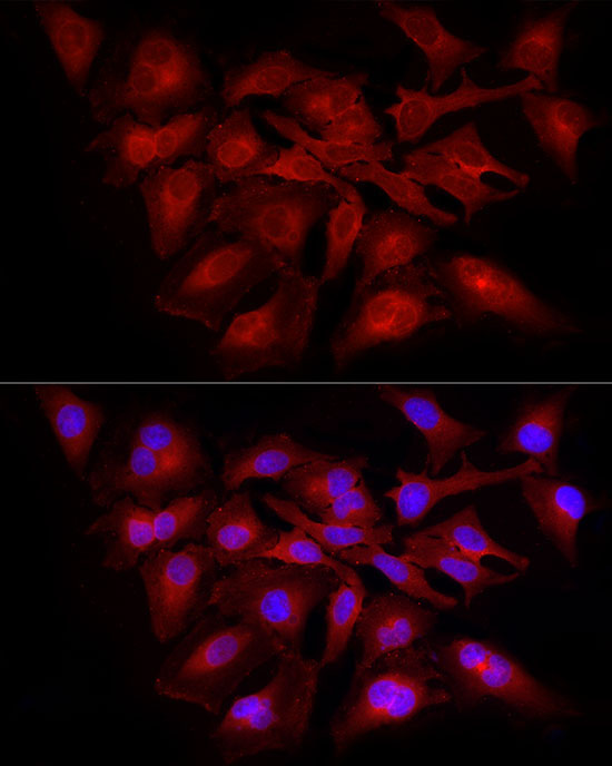 RELA Rabbit Polyclonal Antibody - Image 2