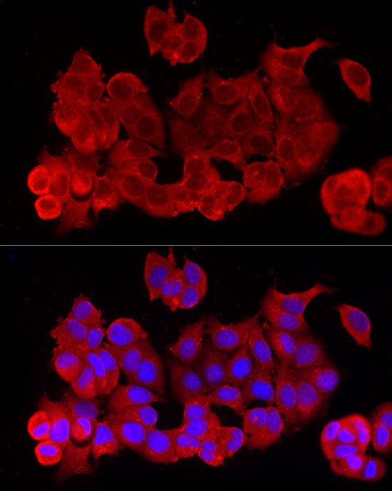 RELA Rabbit Polyclonal Antibody - Image 3