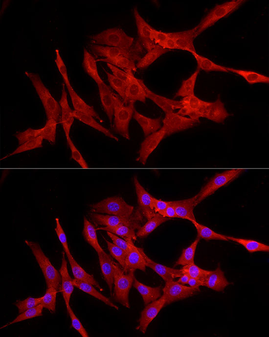 RELA Rabbit Polyclonal Antibody - Image 4