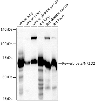 Rev-erb beta/NR1D2 Rabbit Polyclonal Antibody