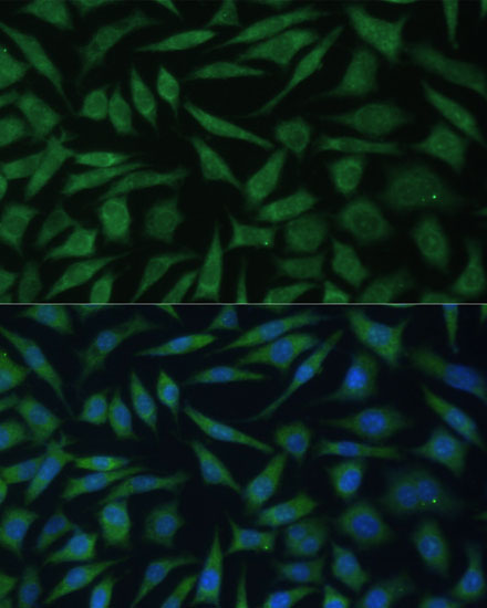 REXO2 Rabbit Polyclonal Antibody - Image 2