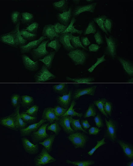 REXO2 Rabbit Polyclonal Antibody - Image 3