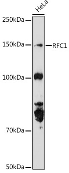 RFC1 Rabbit Polyclonal Antibody - Image 2