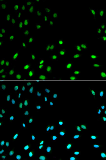 RFC1 Rabbit Polyclonal Antibody - Image 3