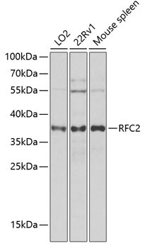 RFC2 Rabbit Polyclonal Antibody