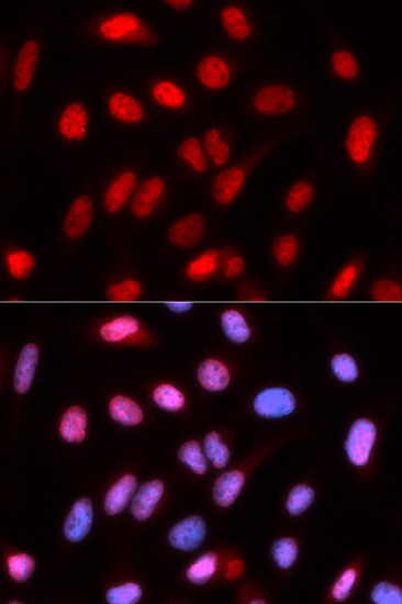 RFC4 Rabbit Polyclonal Antibody - Image 2