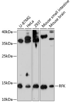 RFK Rabbit Polyclonal Antibody