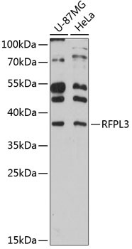 RFPL3 Rabbit Polyclonal Antibody