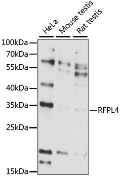 RFPL4 Rabbit Polyclonal Antibody