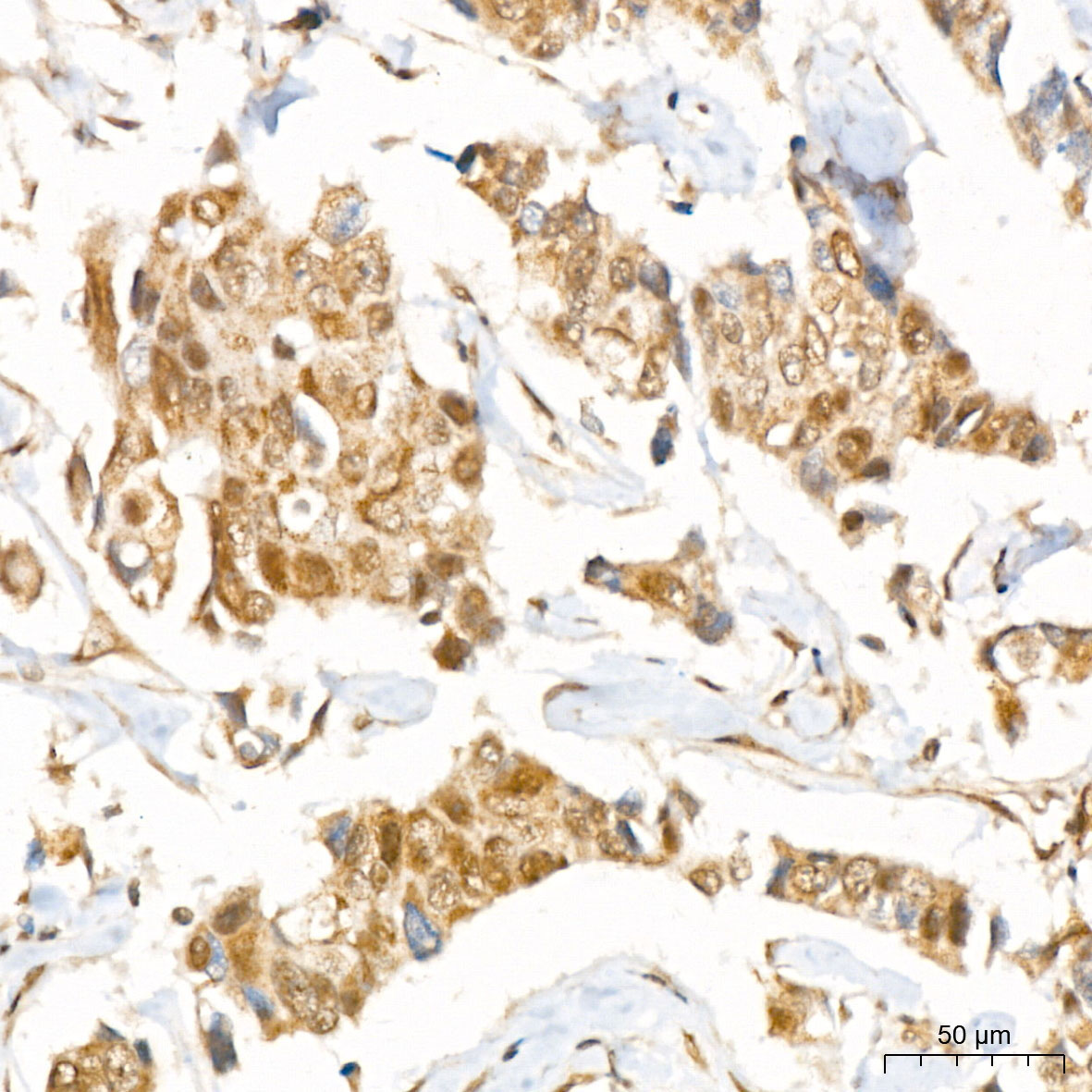 RFWD2 Rabbit Polyclonal Antibody - Image 2