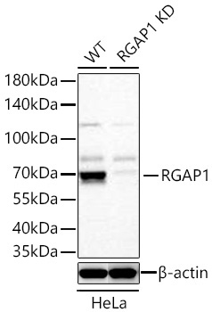 RGAP1 Rabbit Monoclonal Antibody