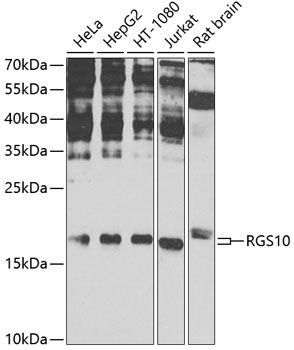 RGS10 Rabbit Polyclonal Antibody