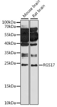 RGS17 Rabbit Polyclonal Antibody