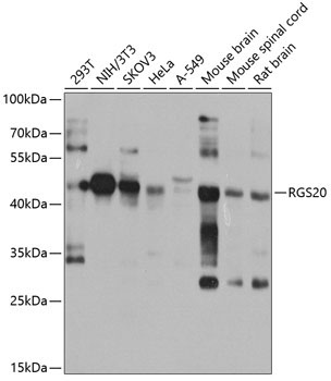 RGS20 Rabbit Polyclonal Antibody