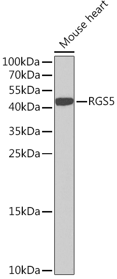 RGS5 Rabbit Polyclonal Antibody