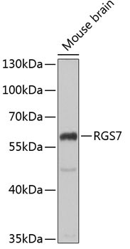 RGS7 Rabbit Polyclonal Antibody