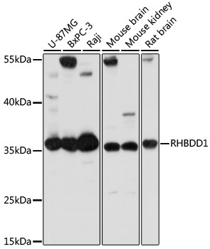 RHBDD1 Rabbit Polyclonal Antibody