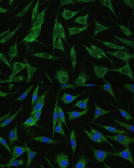 RHBDD1 Rabbit Polyclonal Antibody - Image 2