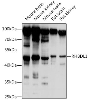 RHBDL1 Rabbit Polyclonal Antibody