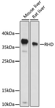 RHD Rabbit Polyclonal Antibody