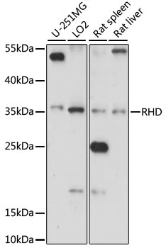 RHD Rabbit Polyclonal Antibody