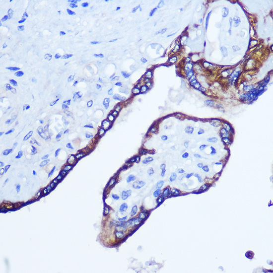 RhoA Rabbit Polyclonal Antibody - Image 3