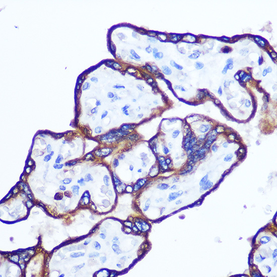 RhoA Rabbit Polyclonal Antibody - Image 4
