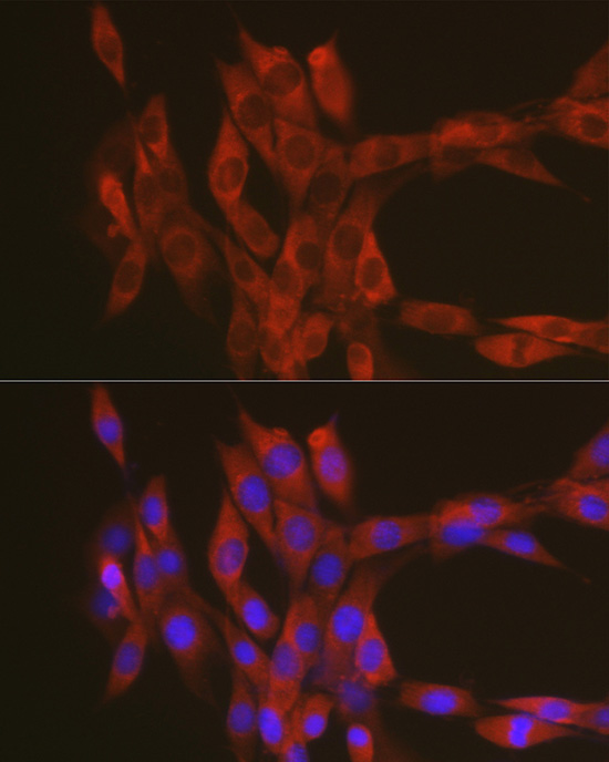 RhoA Rabbit Polyclonal Antibody - Image 5