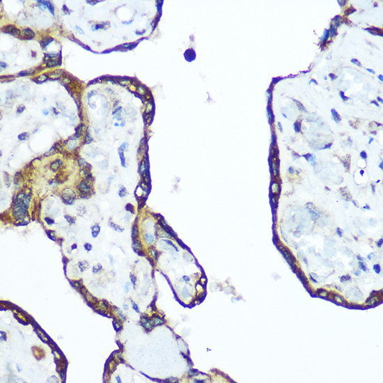 RhoA Rabbit Polyclonal Antibody - Image 2