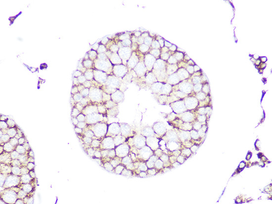 RHOA/RHOB/RHOC Rabbit Monoclonal Antibody - Image 2