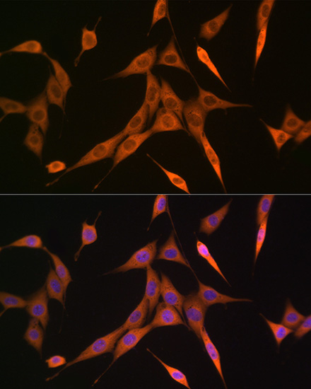 RHOA/RHOB/RHOC Rabbit Monoclonal Antibody - Image 3
