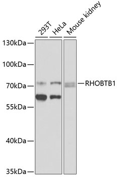 RHOBTB1 Rabbit Polyclonal Antibody