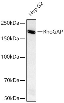 RhoGAP Rabbit Monoclonal Antibody