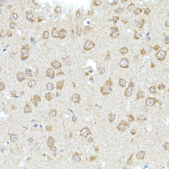 RHOT2 Rabbit Polyclonal Antibody - Image 2