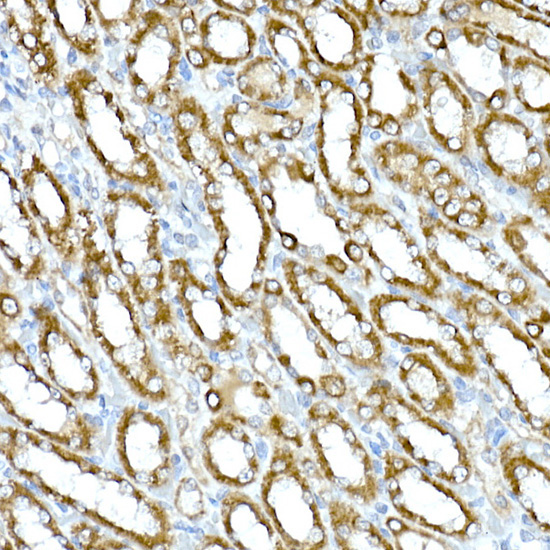 RHOT2 Rabbit Polyclonal Antibody - Image 3