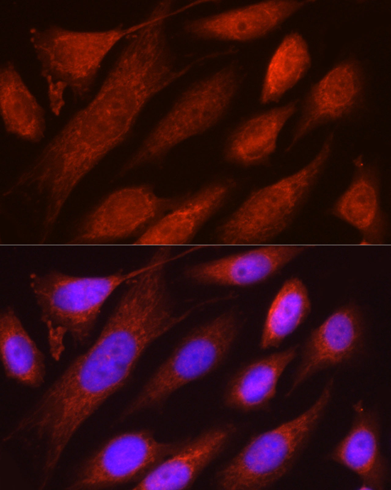 RHOT2 Rabbit Polyclonal Antibody - Image 4