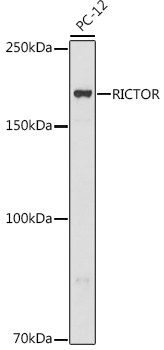 RICTOR Rabbit Polyclonal Antibody