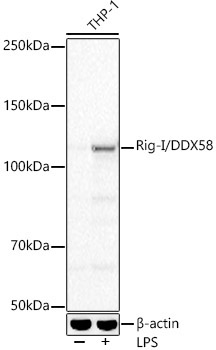 Rig-I/DDX58 Rabbit Monoclonal Antibody