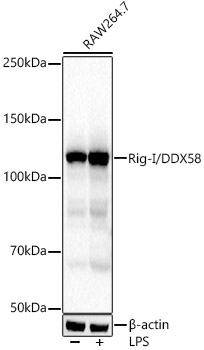 Rig-I/DDX58 Rabbit Monoclonal Antibody - Image 2