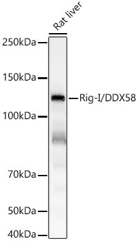 Rig-I/DDX58 Rabbit Monoclonal Antibody