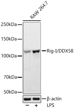 Rig-I/DDX58 Rabbit Monoclonal Antibody - Image 2