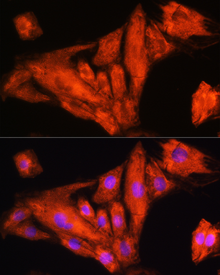 Rig-I/DDX58 Rabbit Polyclonal Antibody - Image 2