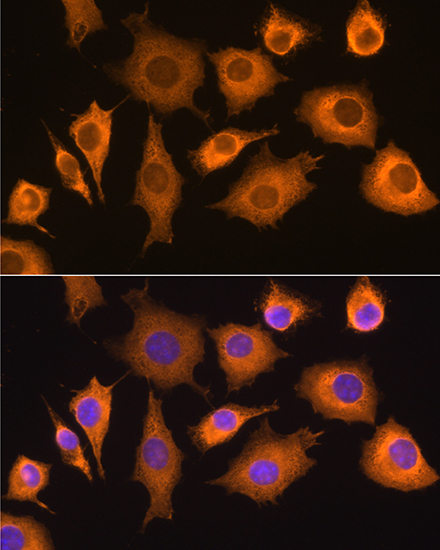 Rig-I/DDX58 Rabbit Polyclonal Antibody - Image 3