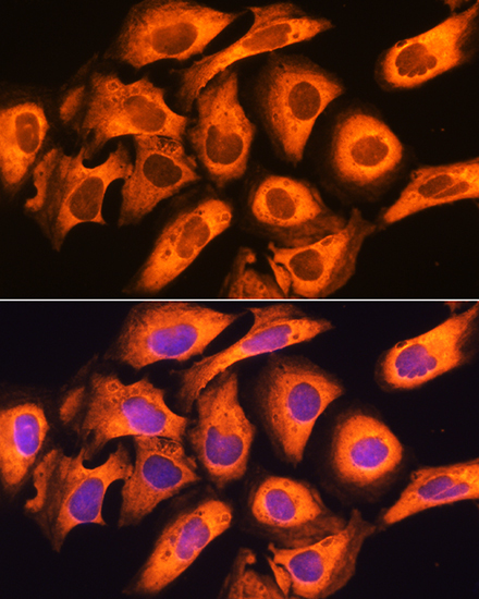 Rig-I/DDX58 Rabbit Polyclonal Antibody - Image 4
