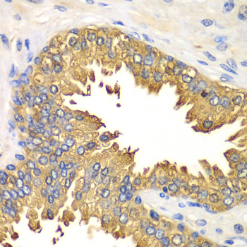 Rig-I/DDX58 Rabbit Polyclonal Antibody - Image 2