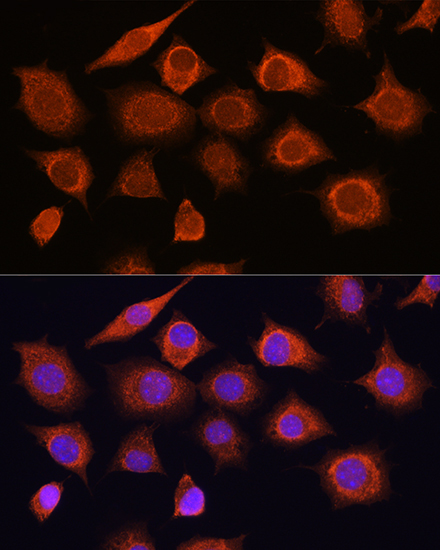 Rig-I/DDX58 Rabbit Polyclonal Antibody - Image 3
