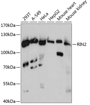 RIN2 Rabbit Polyclonal Antibody