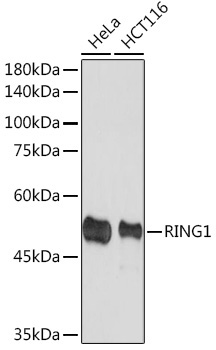 RING1A Rabbit Monoclonal Antibody