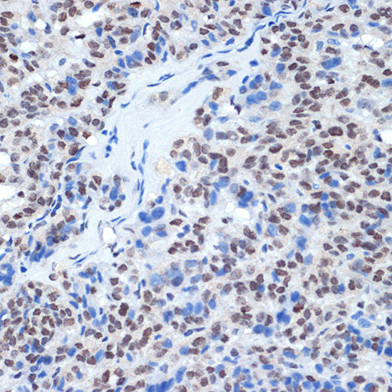 RING1A Rabbit Monoclonal Antibody - Image 2